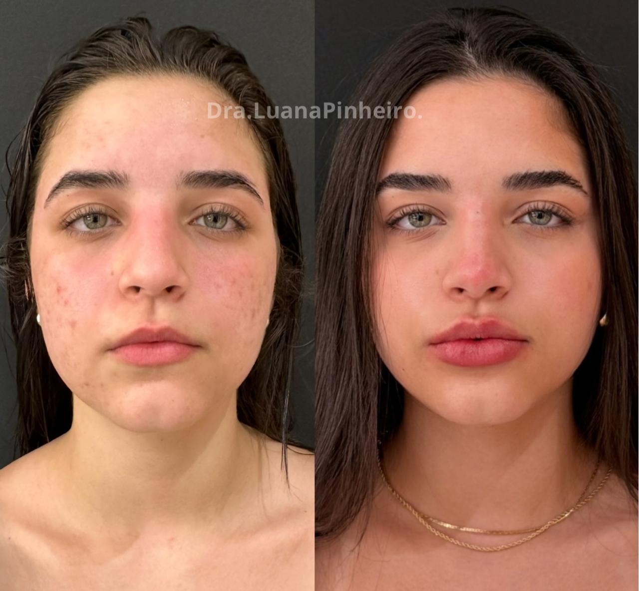Skinbooster